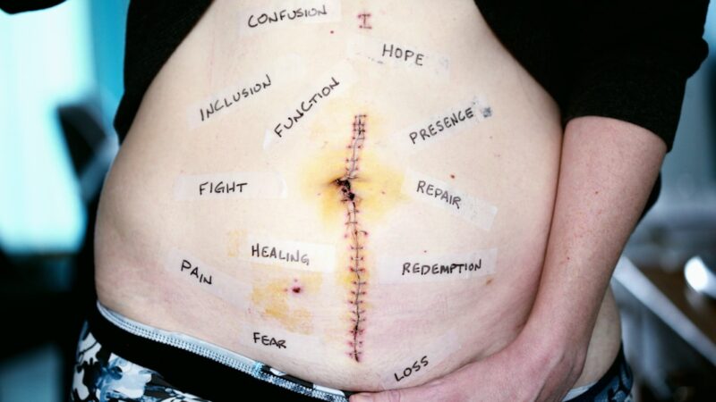 Forståelse af PTSD: En dybdegående artikel